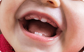 年齢や口内環境に合わせた豊富な治療方法がある