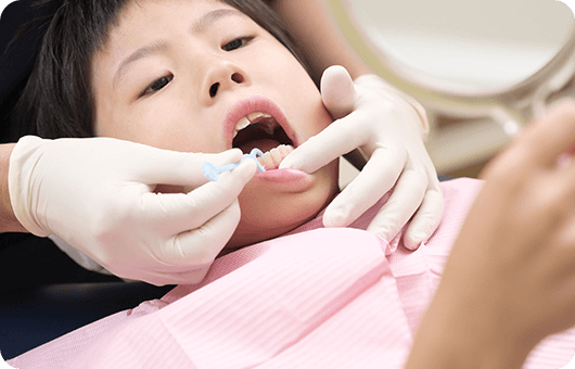 PMTC・歯のクリーニング